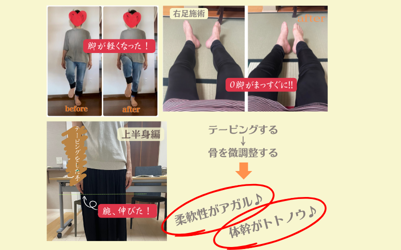 エコルヴェ　テーピング  正方形 (700 x 500 px)